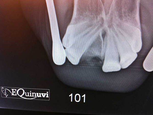 rx-odontologia